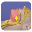 An illustration of a normal throat assaociated with sleep apnea.